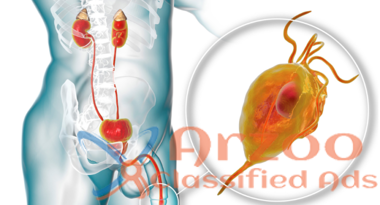 Urethritis